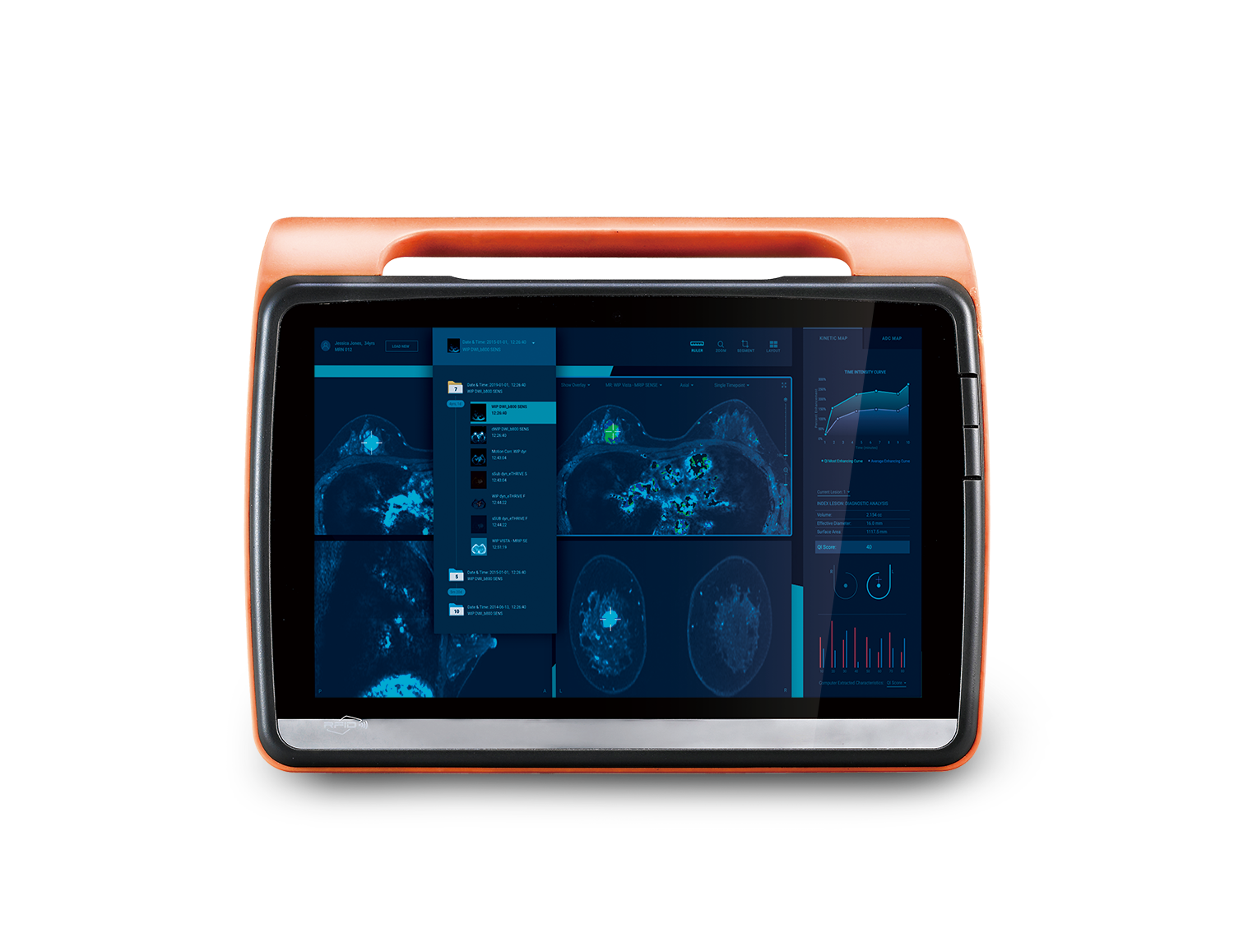 医療用タブレット